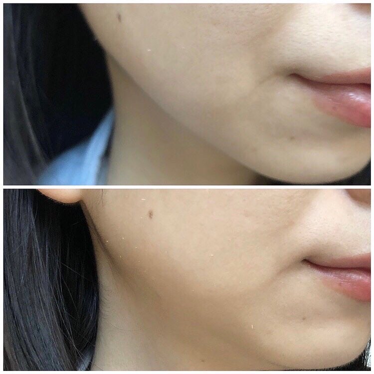 スーパーシカクッション/MEDICUBE/クッションファンデーションを使ったクチコミ(6枚目)