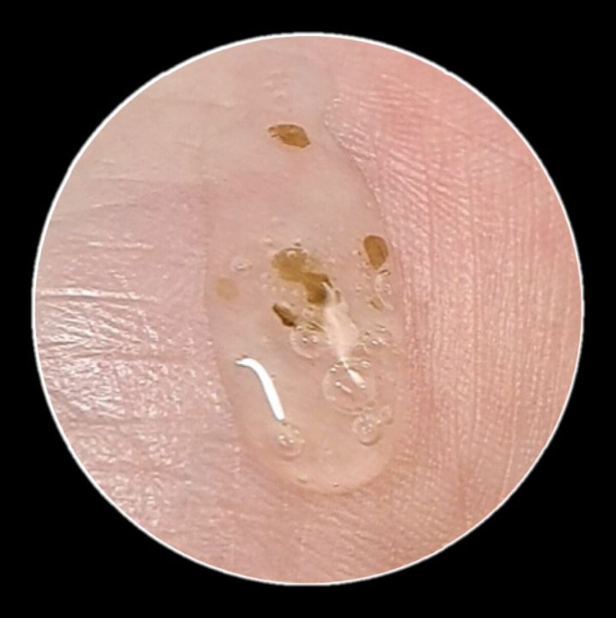 AC Balancing Serum/Ongredients/美容液を使ったクチコミ(4枚目)