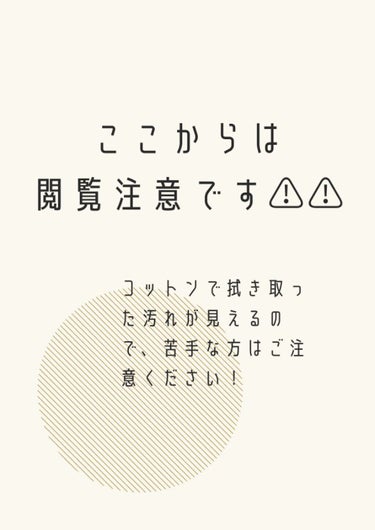 オードムーゲ 薬用ローション（ふきとり化粧水）/オードムーゲ/拭き取り化粧水を使ったクチコミ（4枚目）