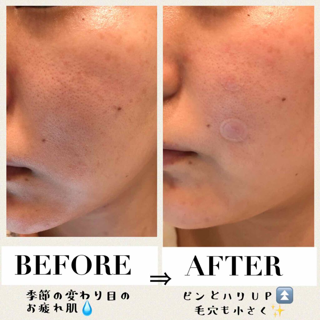 トータルリヴァイタライズ マスク/アテニア/シートマスク・パックを使ったクチコミ(3枚目)