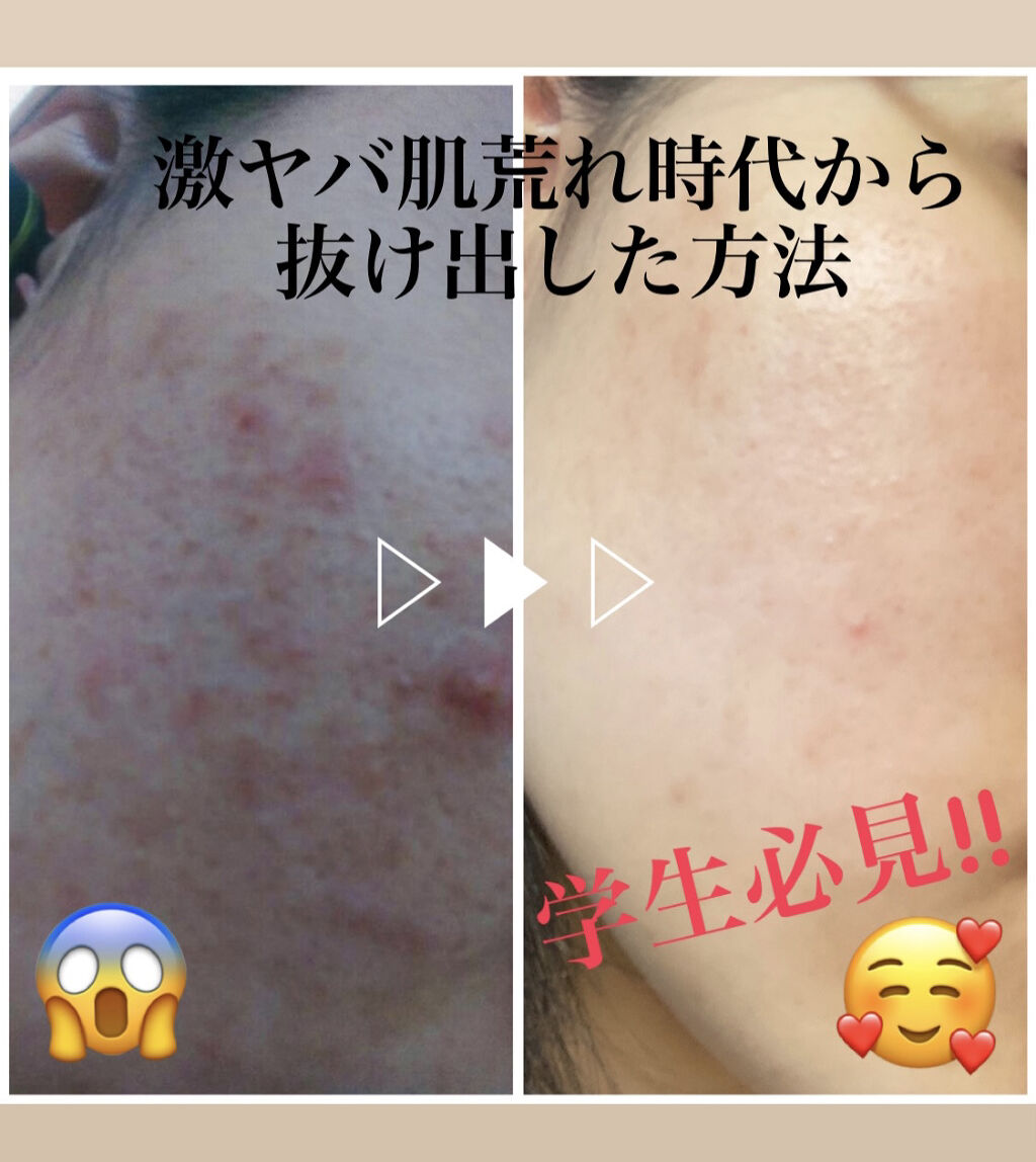 サンホワイトP-1/サンホワイト/ボディクリームを使ったクチコミ（1枚目）