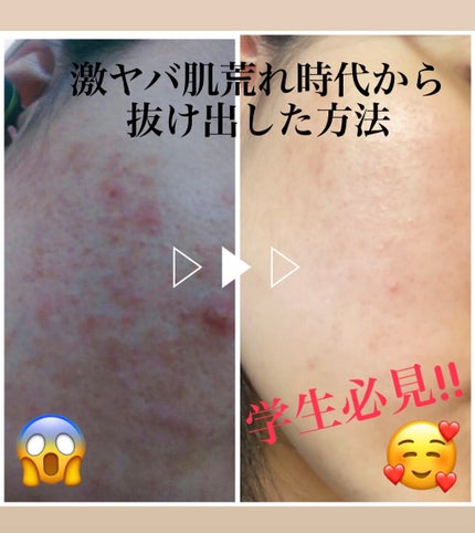 サンホワイトP-1/サンホワイト/ボディクリームを使ったクチコミ(1枚目)