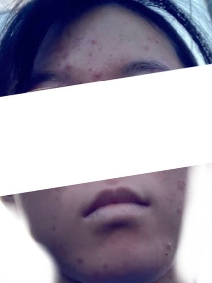 ワセリン/大洋製薬/ボディクリームを使ったクチコミ(2枚目)