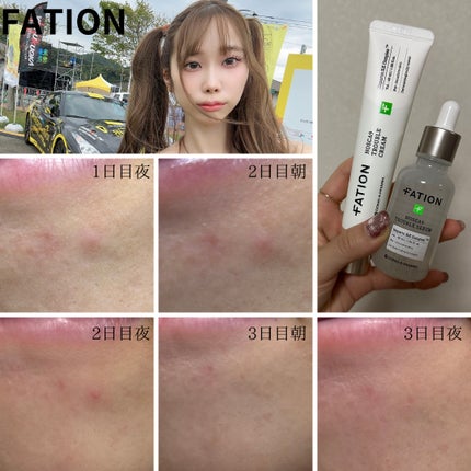 ノスカナイン トラブル セラム/FATION/美容液を使ったクチコミ(1枚目)