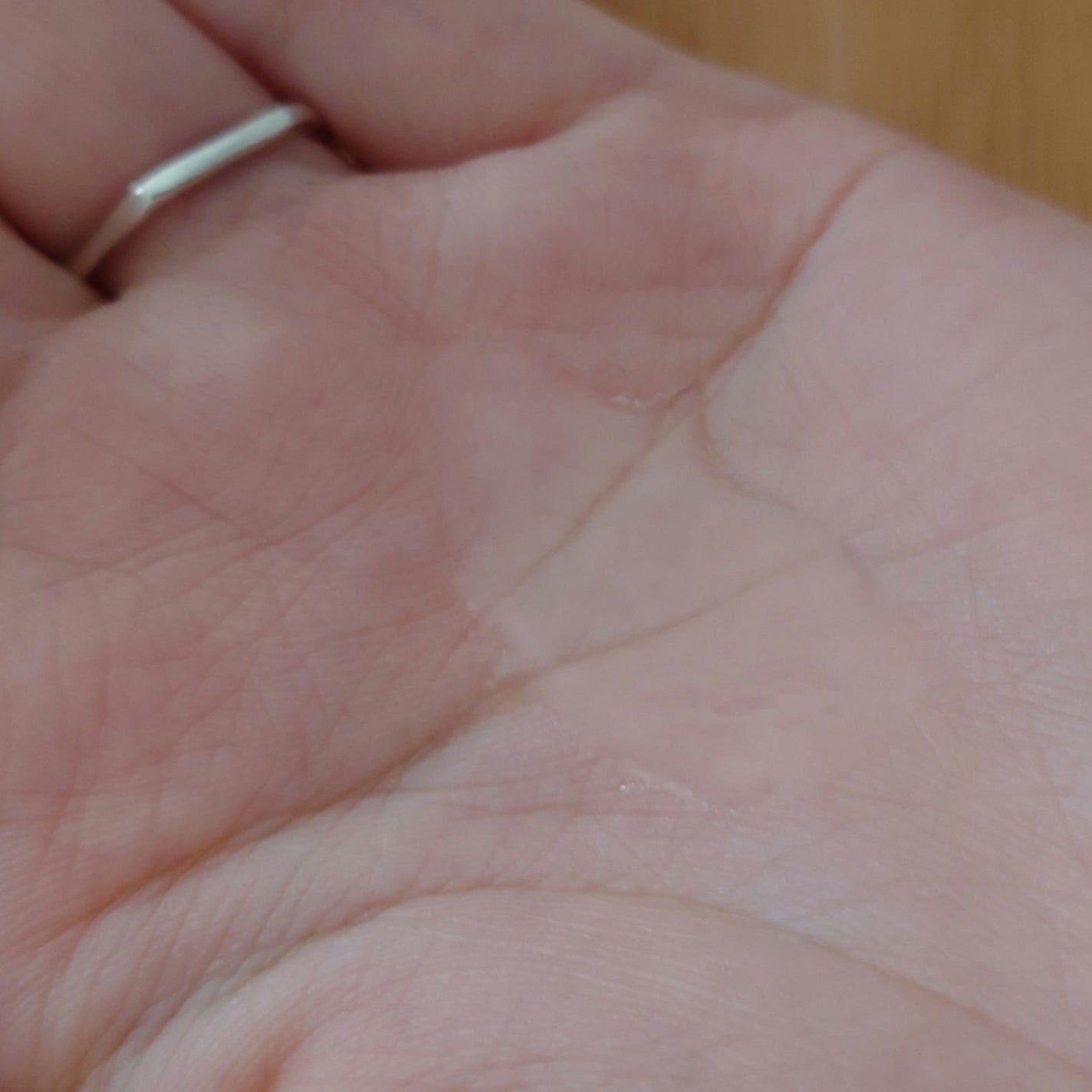 アドバンスド エッセンスオイル AG/immuno/美容液を使ったクチコミ(3枚目)