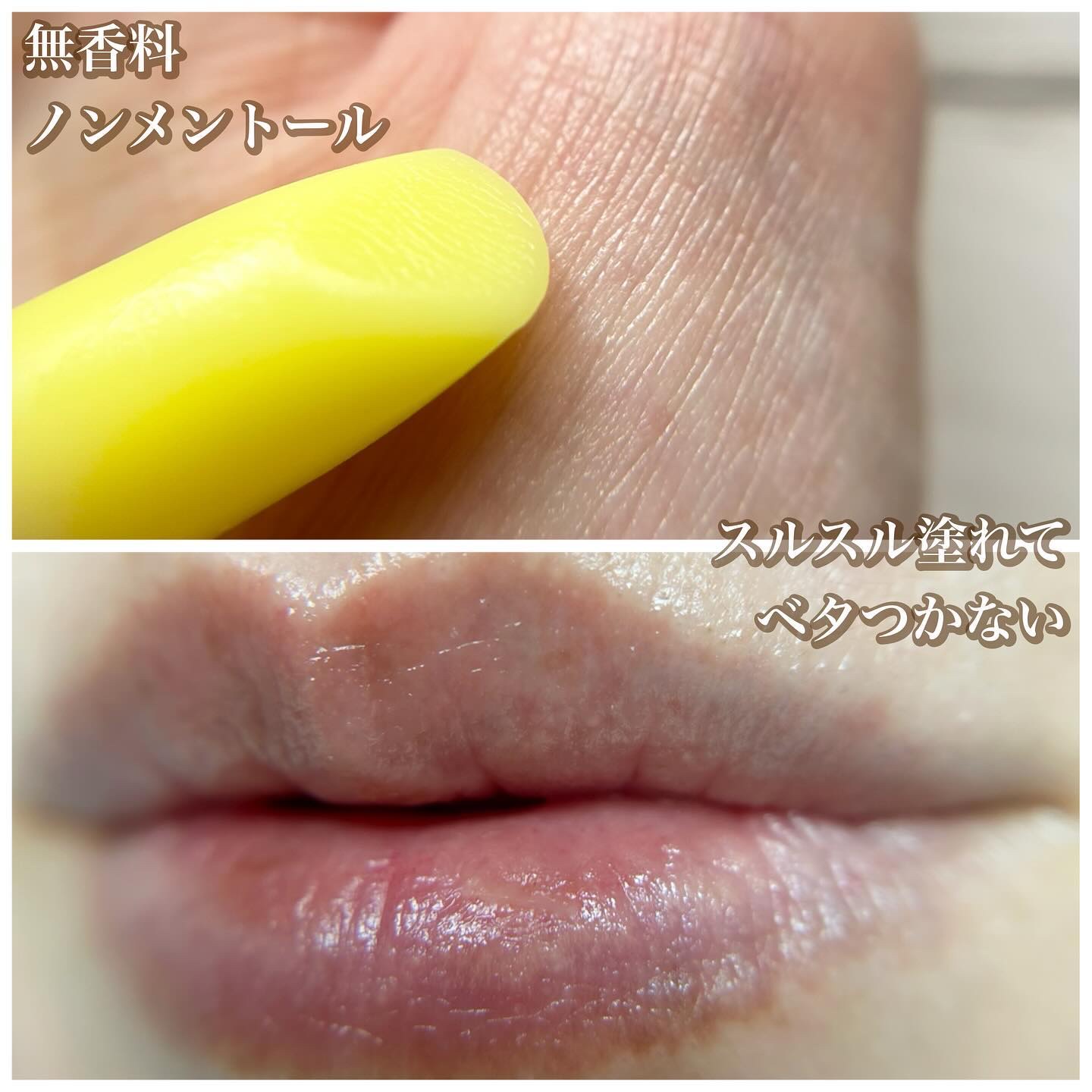 ユースキン メディカルリップスティック/ユースキン/リップクリームを使ったクチコミ（2枚目）