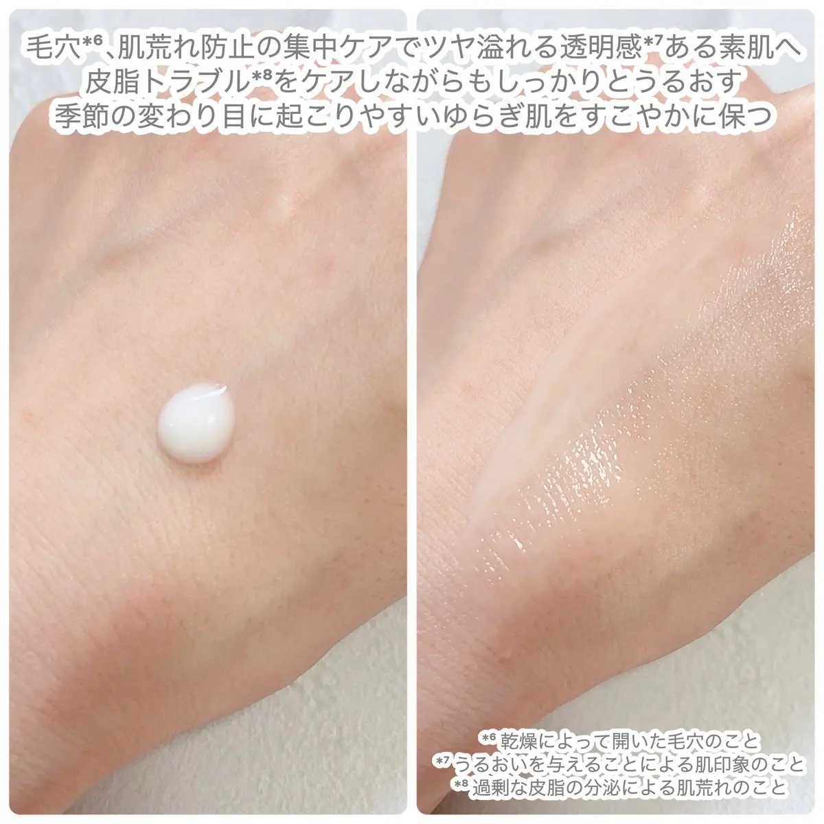 アゼペア 美容液/ネイチャーリパブリック/美容液を使ったクチコミ（3枚目）