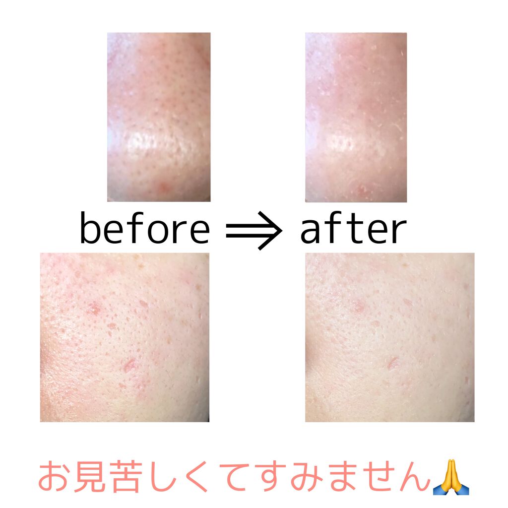 スフレ感CCクリーム	/SUGAO®/CCクリームを使ったクチコミ(2枚目)