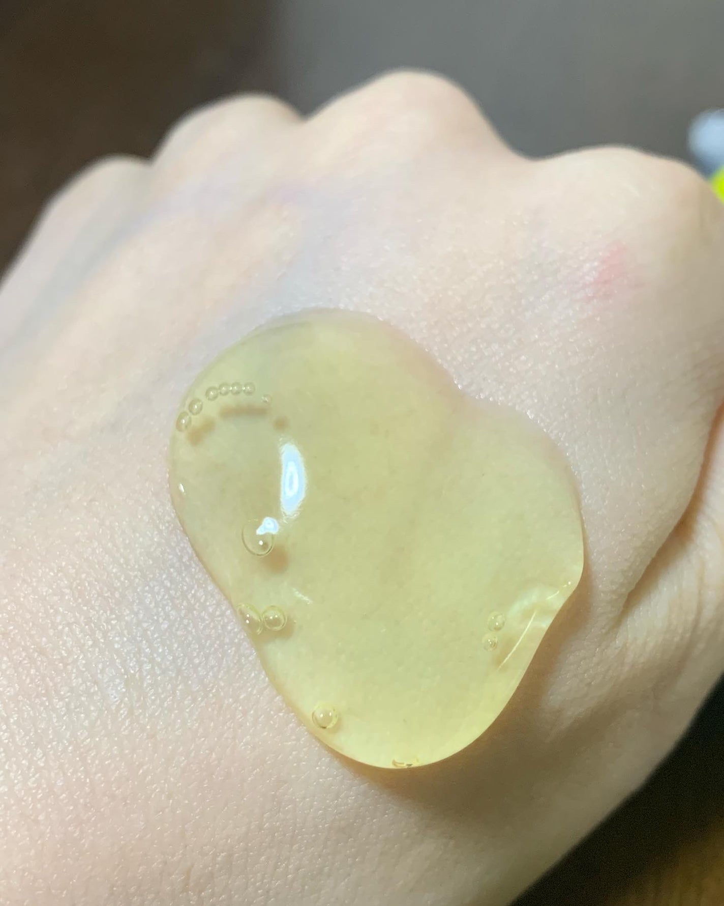 ドットバスター クレンジングジェル/ドットバスター/クレンジングジェルを使ったクチコミ(2枚目)