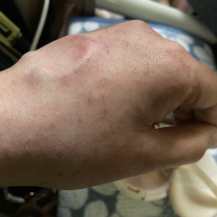 スキンティント トーンアップ パウダー(おしろい)/フォーチュン/プレストパウダーを使ったクチコミ(5枚目)