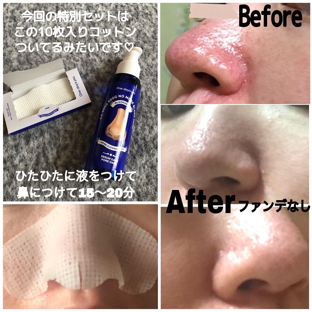 ノーモアブラックヘッド(ノーズピーリング)/One-day's you/スクラブ・ゴマージュを使ったクチコミ（2枚目）