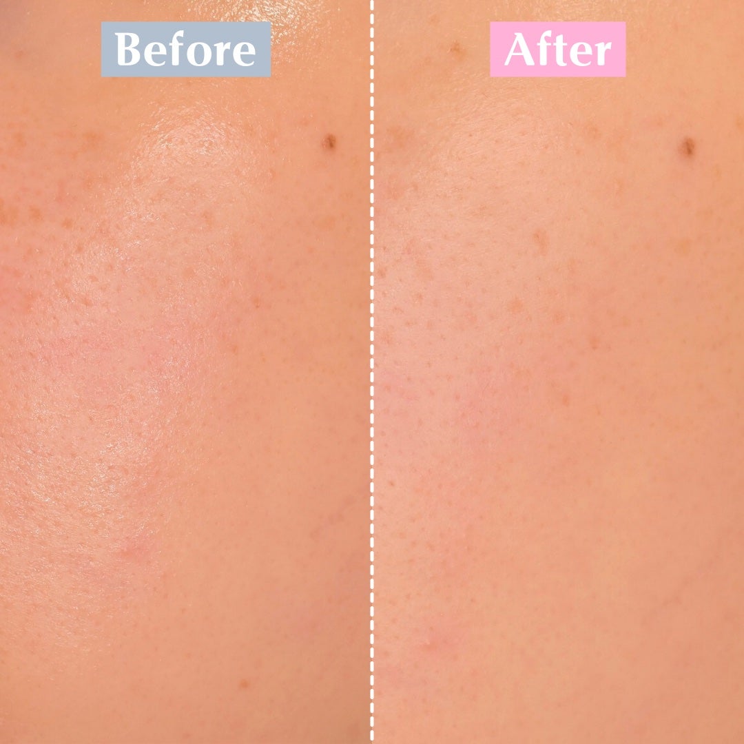 バイオームパーフェクトさらさらUVスティック/UIQ/日焼け止めスティックを使ったクチコミ(10枚目)