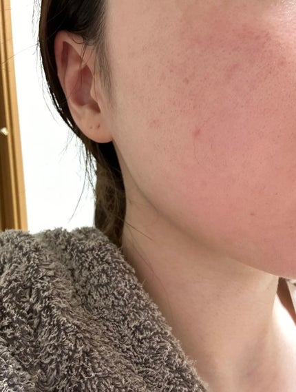 &honey クレンジングバーム モイスト/&honey/クレンジングバームを使ったクチコミ(1枚目)