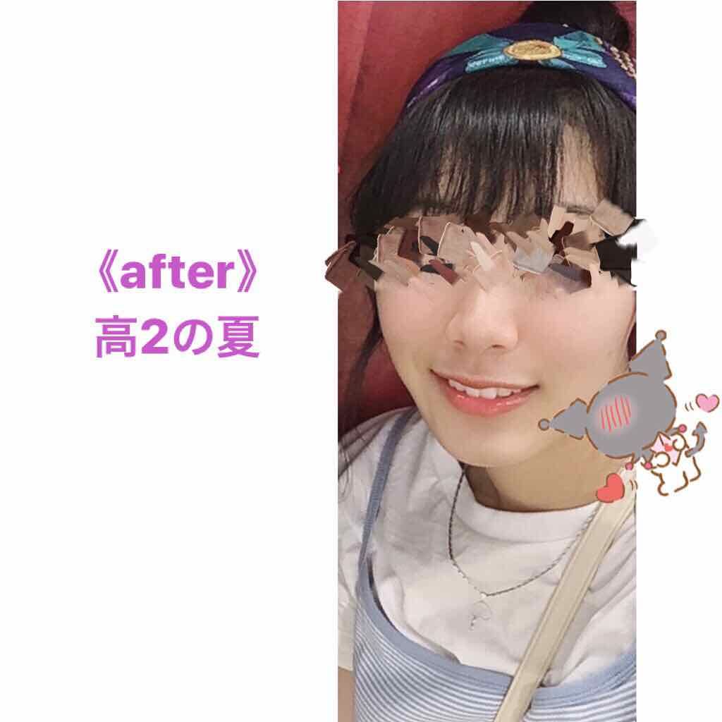 天然こんにゃくパフ/DAISO/その他スキンケアグッズを使ったクチコミ（3枚目）