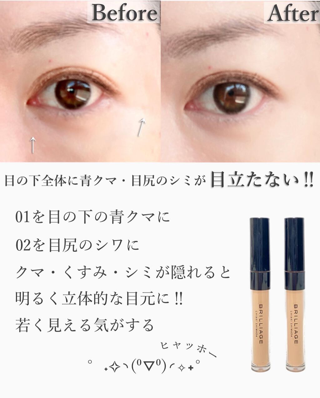 デザイニング コンシーラー/ブリリアージュ/リキッドコンシーラーを使ったクチコミ(6枚目)