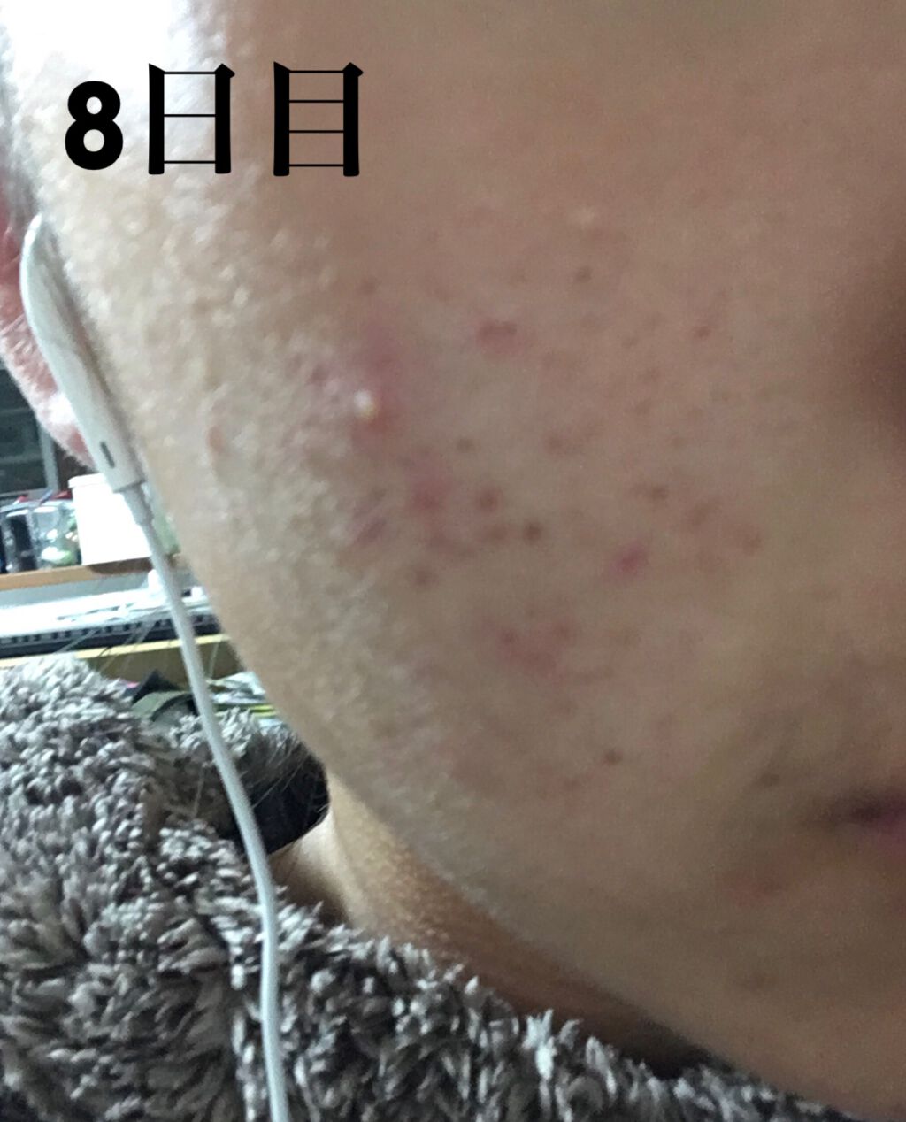 パワーマスク/ラッシュ/洗い流すパック・マスクを使ったクチコミ（2枚目）