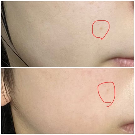 ユース ラディアンス ビタチノール セラム/primera/美容液を使ったクチコミ(4枚目)