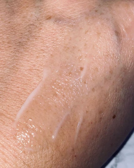 メディリフト ニードルリフトクリーム/YA-MAN TOKYO JAPAN/フェイスクリームを使ったクチコミ(5枚目)