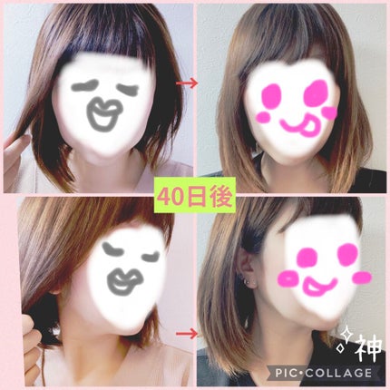 NICOBELT(ニコベルト)/VONMIE/美顔器・マッサージを使ったクチコミ(2枚目)