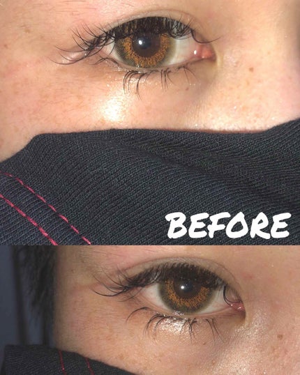 のびーるアイテープ(絆創膏タイプ、レギュラー)/DAISO/二重まぶた用アイテムを使ったクチコミ(1枚目)