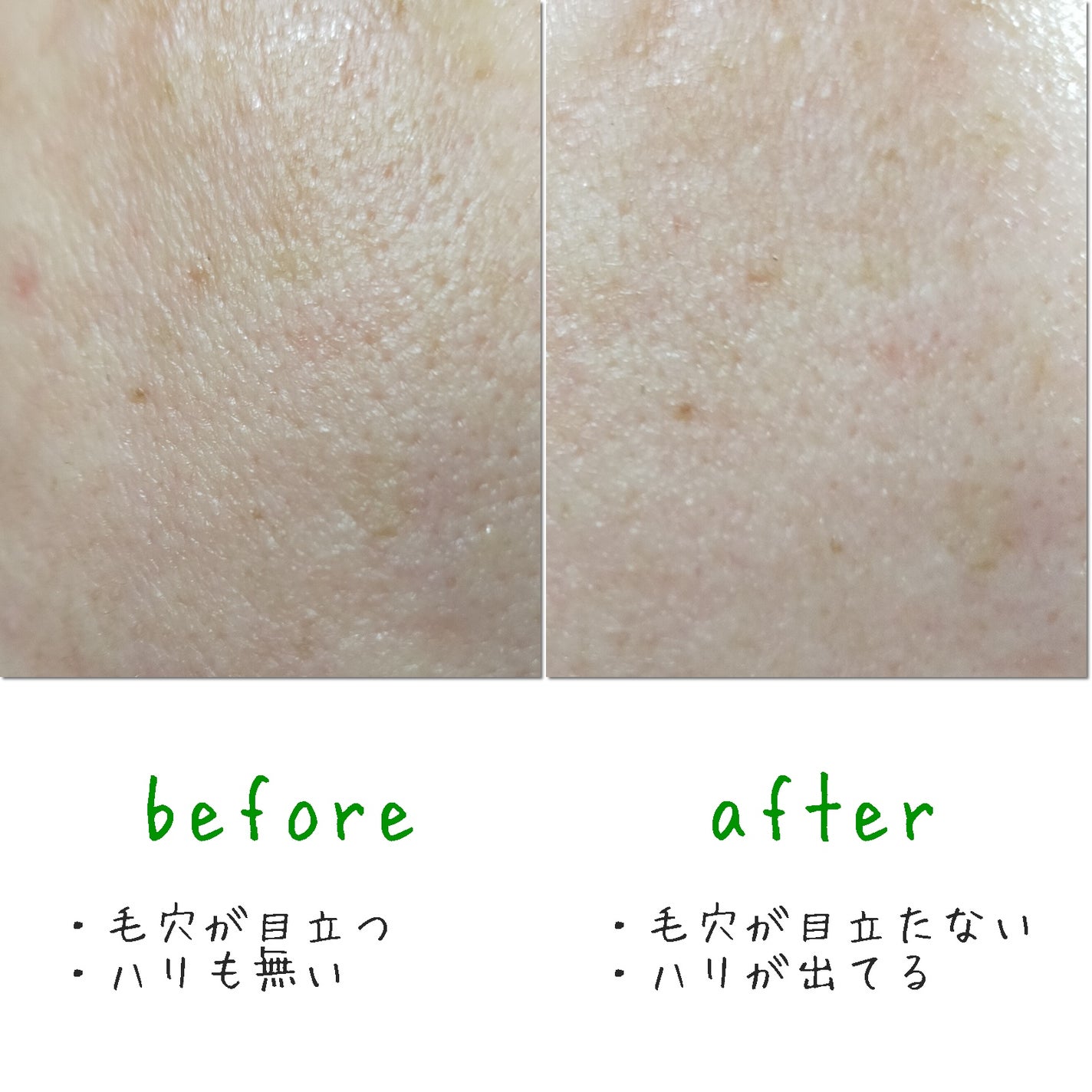 CICA デイリースージングマスク/VT/シートマスク・パックを使ったクチコミ(7枚目)