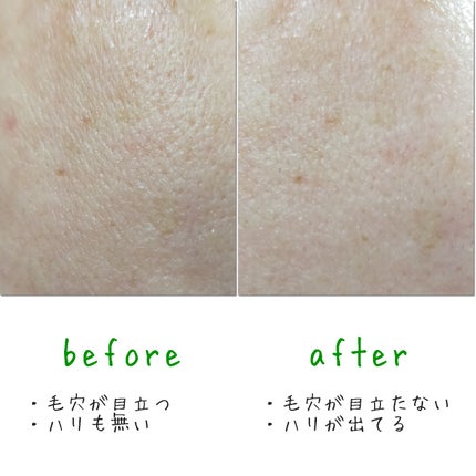 CICA デイリースージングマスク/VT/シートマスク・パックを使ったクチコミ(7枚目)