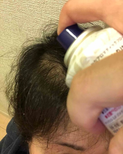 セグレタ髪を育むスプレー/セグレタ/頭皮ローションを使ったクチコミ(2枚目)