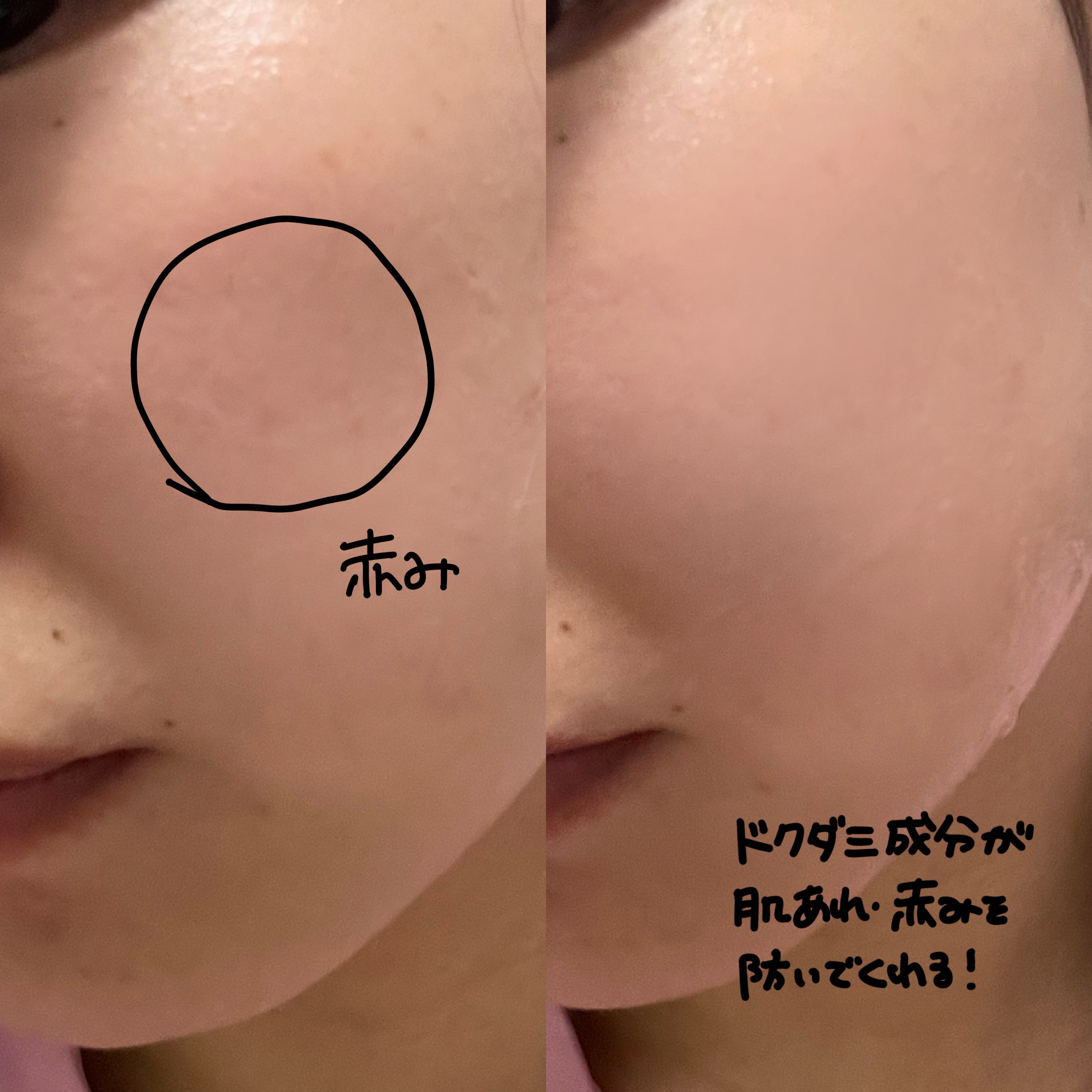 を使ったクチコミ（2枚目）