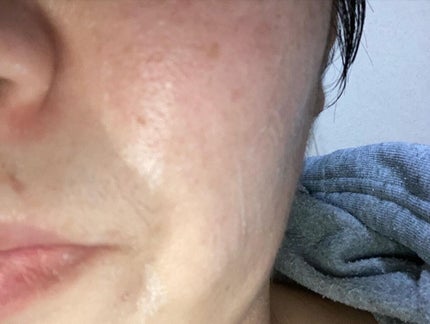 にゃんこ on LIPS 「ピアベルピア化粧品プレミアムシリーズトライアルセット試してみま..」(10枚目)