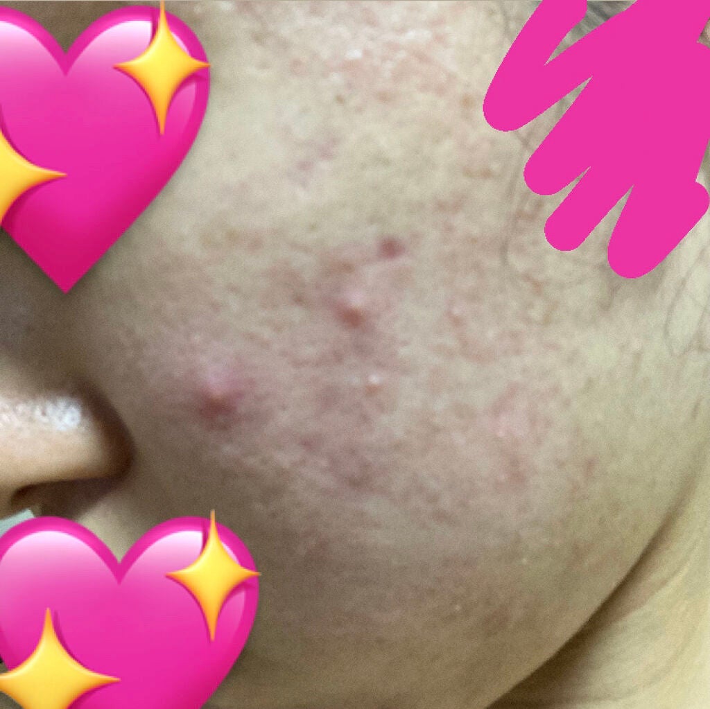 ハトムギ化粧水(ナチュリエ スキンコンディショナー R )/ナチュリエ/化粧水を使ったクチコミ(3枚目)