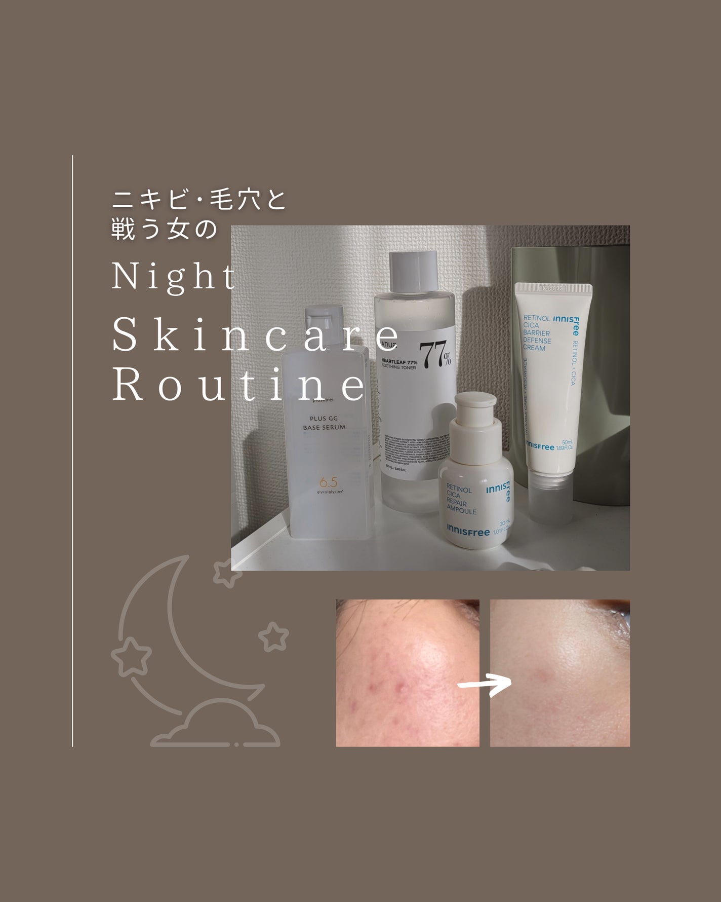 ドクダミ 77 スージングトナー/Anua/化粧水を使ったクチコミ(1枚目)