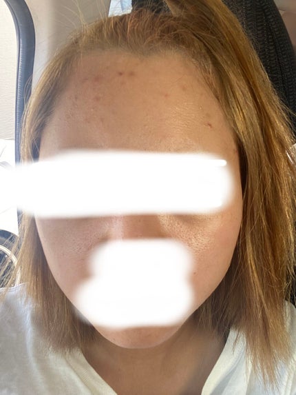 を使ったクチコミ(1枚目)