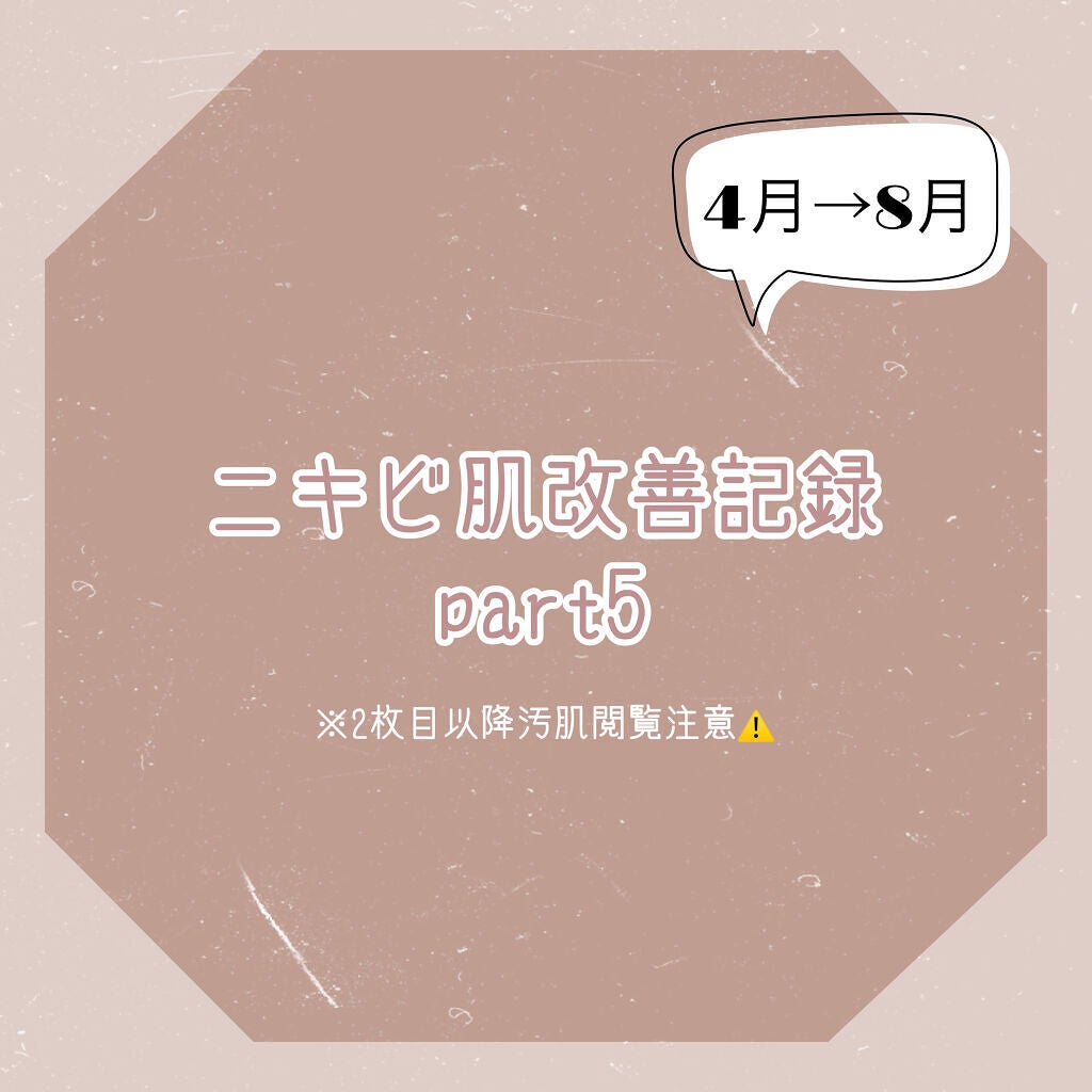 あん on LIPS 「【ニキビ肌改善記録 part5】2021/04/06→2021..」(1枚目)