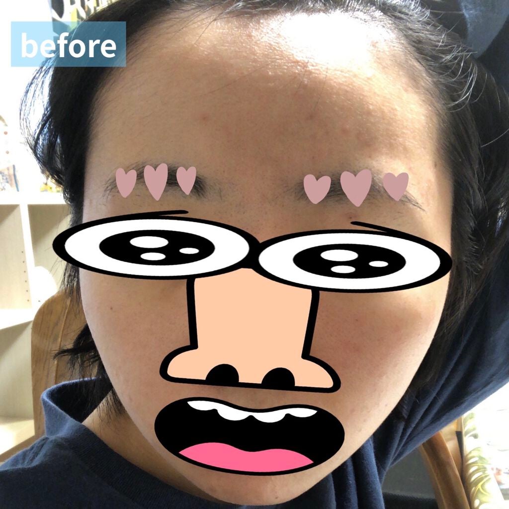 メルライン/リアルビューティーケア/オールインワン化粧品を使ったクチコミ(5枚目)