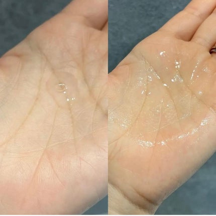 トランスダーマ  C/トランスダーマ/美容液を使ったクチコミ(3枚目)