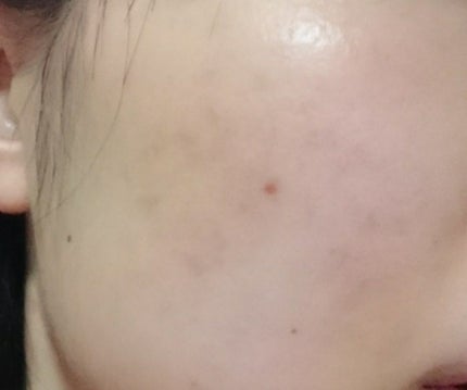 プロポリス エネルギーアンプル/CNP Laboratory/美容液を使ったクチコミ(3枚目)