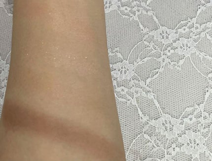 34 エクロジオン