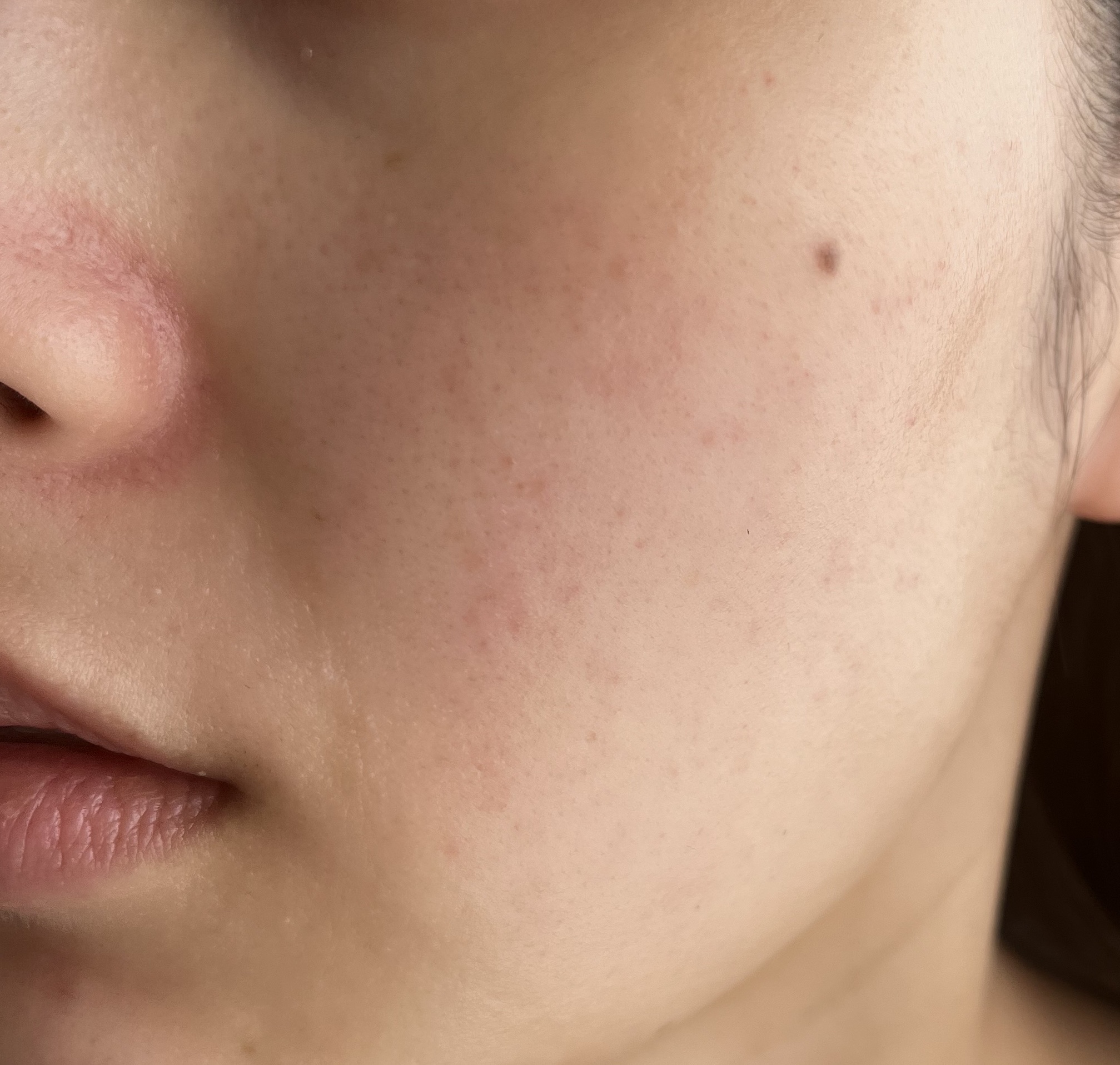 アクティブベース クリアミルク 120mL/オバジ/乳液を使ったクチコミ（2枚目）