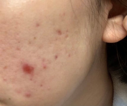 潤浸保湿 乳液/キュレル/乳液を使ったクチコミ(3枚目)