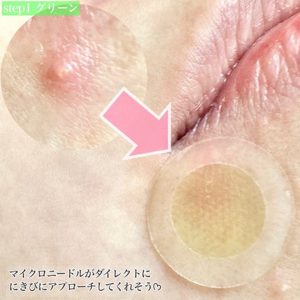 スポットイレイザー/NOLAHOUR/その他スキンケアを使ったクチコミ(3枚目)