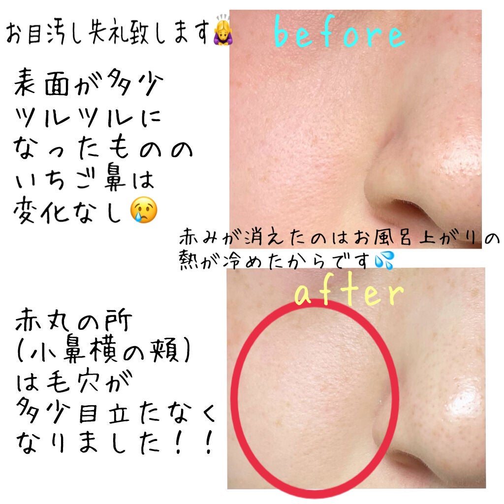 ももぷり フレッシュピールオフパック/ももぷり/ピーリングを使ったクチコミ(3枚目)