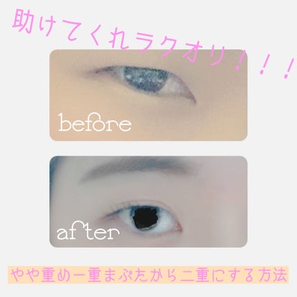 ã®ã³ãã ã¢ã€ããŒã äž¡é¢ããŒãã¿ã€ã/DAISO/äºéãŸã¶ãçšã¢ã€ãã ã䜿ã£ãã¯ãã³ãïŒ1æç®ïŒ