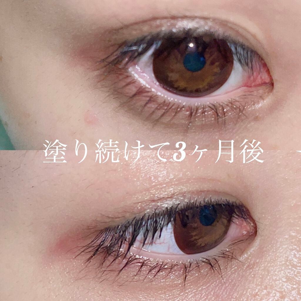 ラッシュアディクト アイラッシュコンディショニングセラム/soaddicted/まつげ美容液を使ったクチコミ(2枚目)