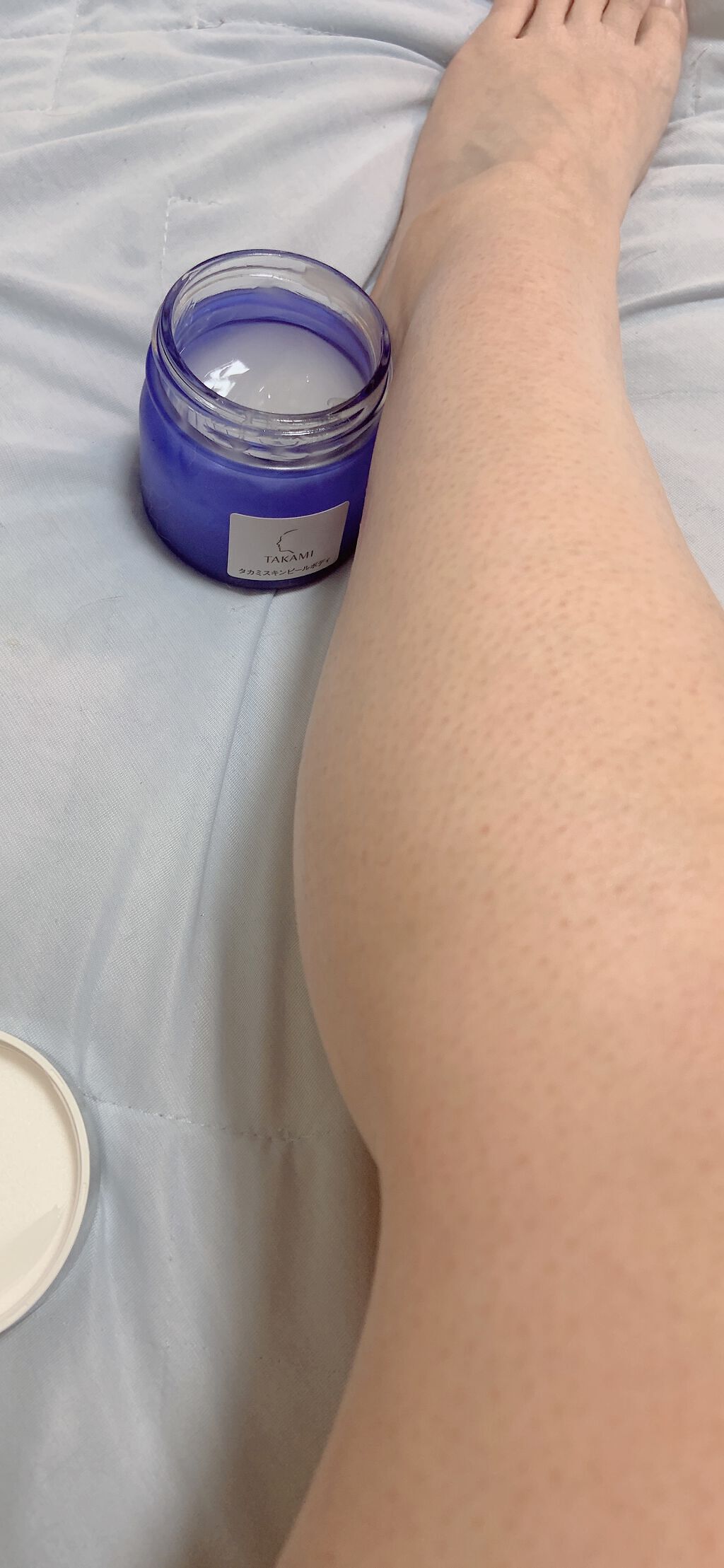 タカミスキンピールボディ/タカミ/ボディローションを使ったクチコミ（3枚目）