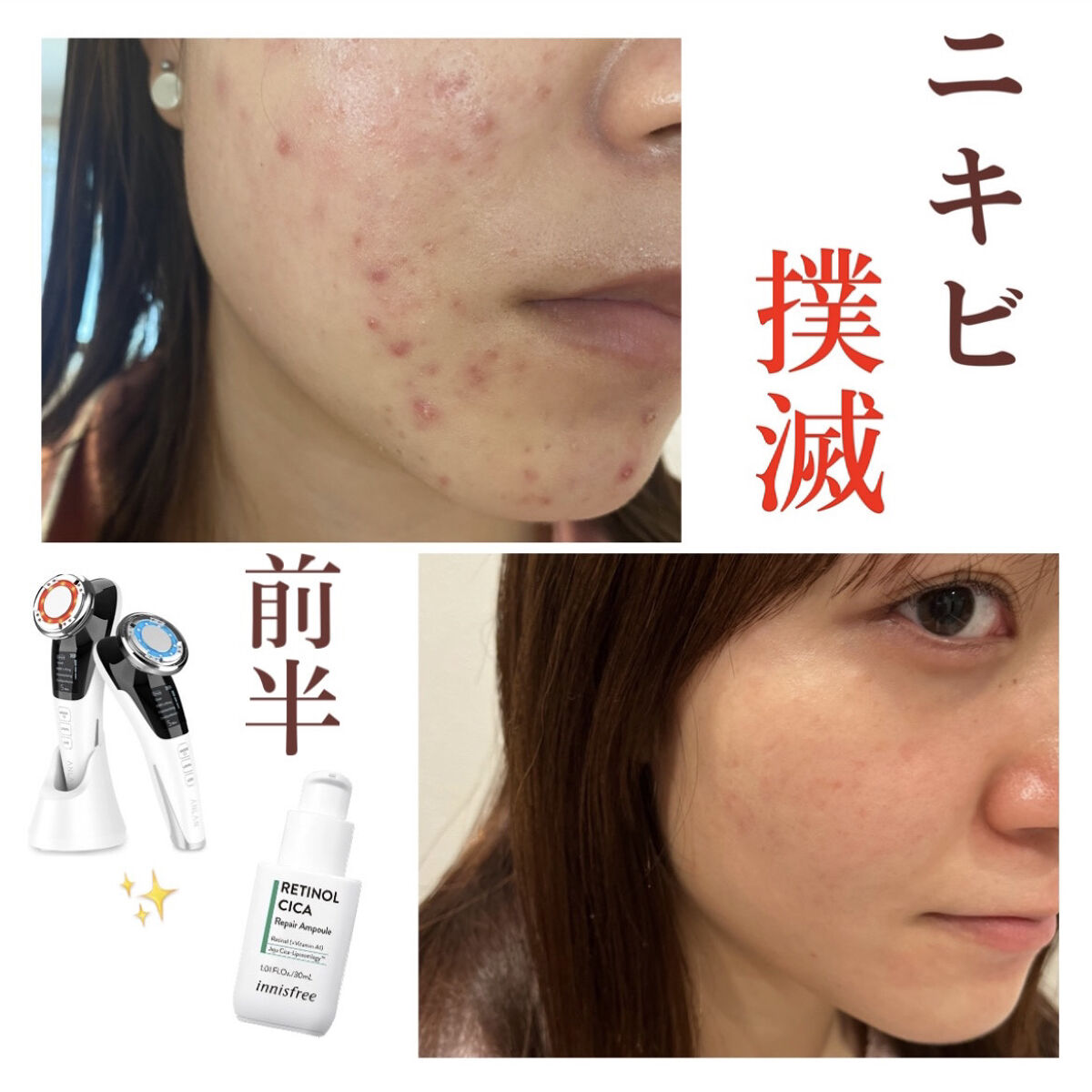 ビフィダシカハーブトナー/manyo/化粧水を使ったクチコミ（1枚目）