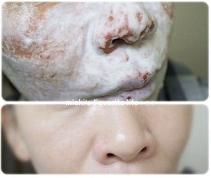 炭酸美容ジェルフェイスパックディオクシー/SENSE O'SIN/洗い流すパック・マスクを使ったクチコミ(1枚目)