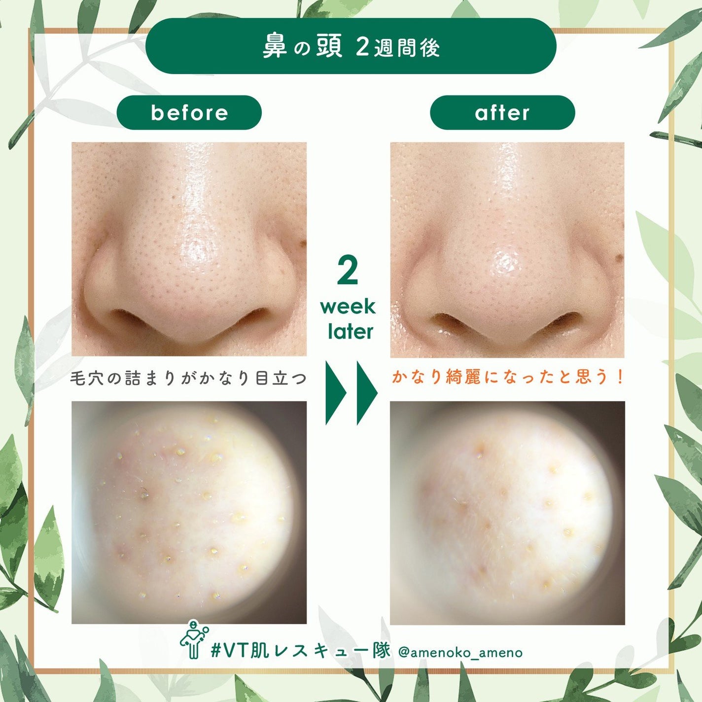 CICA デイリースージングマスク/VT/シートマスク・パックを使ったクチコミ(9枚目)