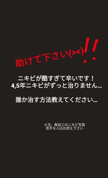 ニキビ酷い on LIPS 「はじめまして！初めての投稿です私は小学校5年生か6年生くらいか..」（1枚目）