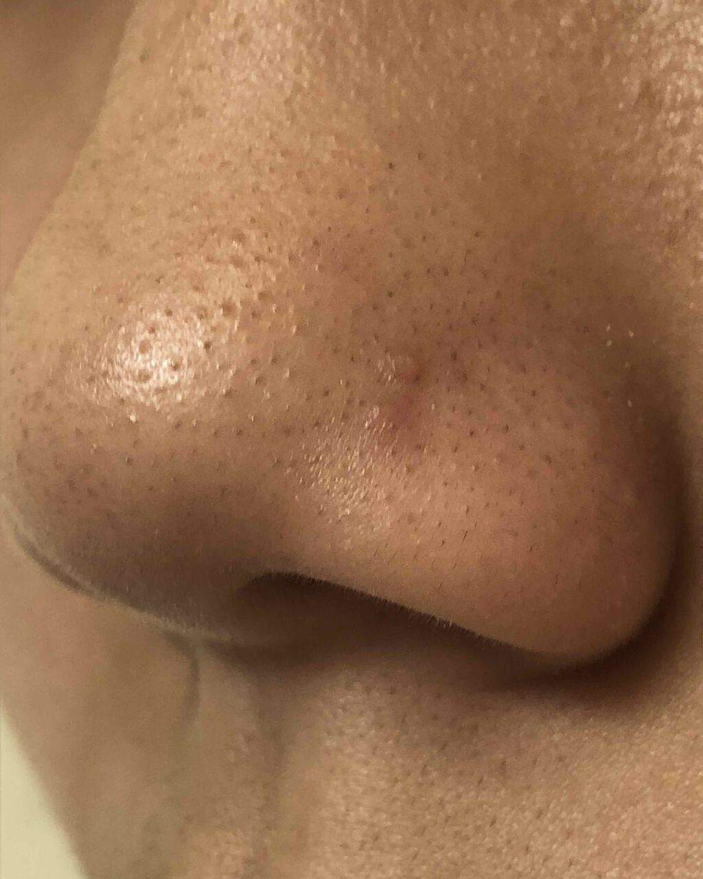 ハトムギ化粧水(ナチュリエ スキンコンディショナー R )/ナチュリエ/化粧水を使ったクチコミ（2枚目）