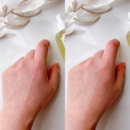 ナイアシンアミドブレミッシュケアセラム/ONE THING/美容液を使ったクチコミ(4枚目)